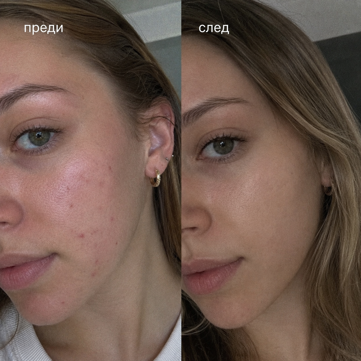 Мицеларна вода от маточина